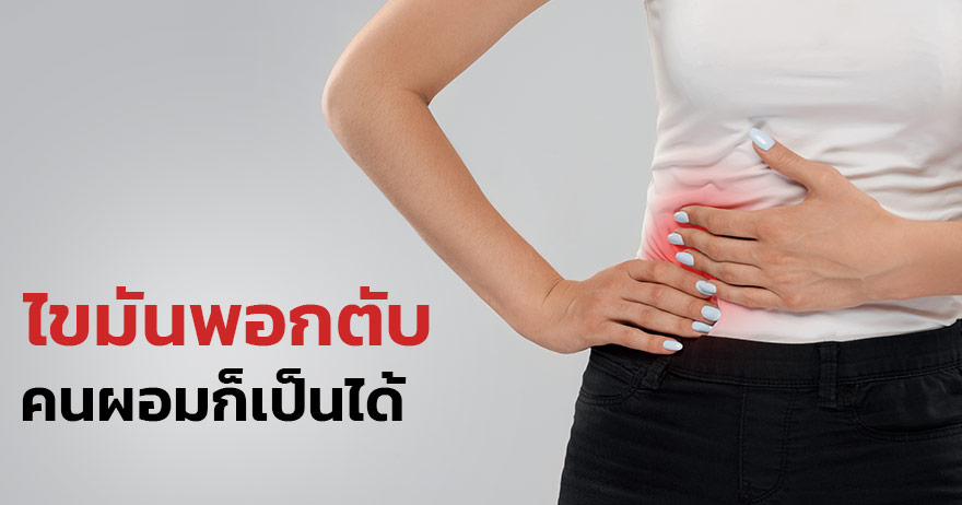 ไขมันพอกตับ ผอมเป็นได้ อายุน้อยก็เป็นได้ ไขมันพอกตับ ผอมเป็นได้ อายุน้อยก็เป็นได้